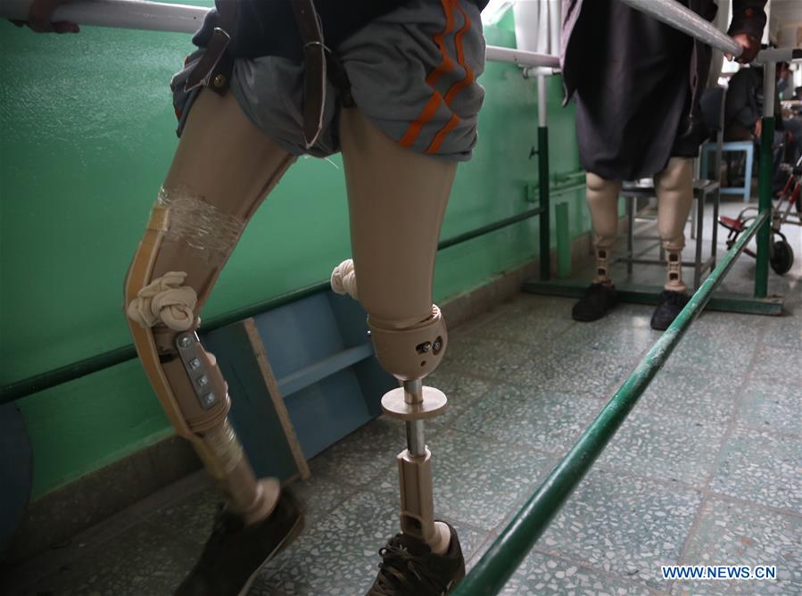 AFGHANISTAN-KABUL-ORTHOPEDIC CENTER-CIVILIAN CASUALTIES