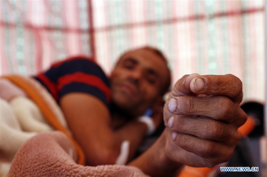 YEMEN-SANAA-CHOLERA-INCREASE